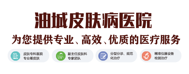 大庆皮炎治疗